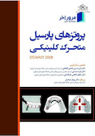 مرور آخر، پروتزهای پارسیل متحرک کلینیکی استوارت (Stewart 2008)